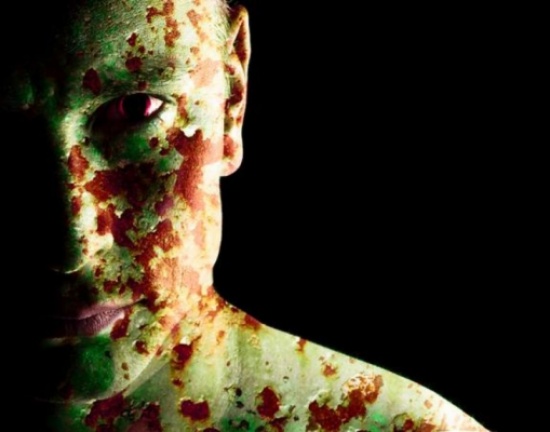 بالصور .. تعرّف أغرب 6 أمراض على الإطلاق