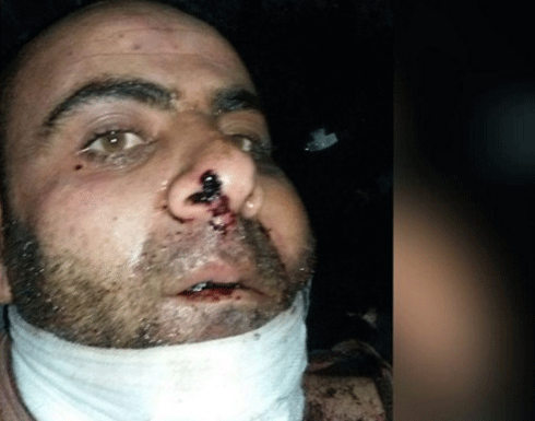 النصرة تبث صورة لأسير جديد من حزب الله اللبناني النصرة تبث صورة لأسير جديد من حزب الله اللبناني