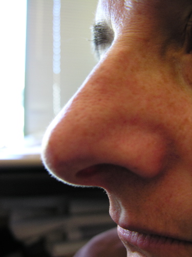 رجل أضاع أنفه