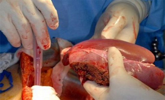 صحفي ألماني يكشف مافيا "الأعضاء" بمصر.. هكذا رد مصريون