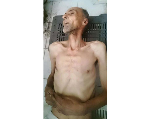 16 وفاة بسبب الجوع في مضايا 16 وفاة بسبب الجوع في مضايا