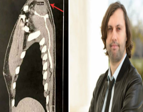 تفاصيل ما قاله تقرير طبي من مستشفى أميركي عن "الطعنة" التي تعرَّض لها المخرج السوري محمد بايزيد في إسطنبول تفاصيل ما قاله تقرير طبي من مستشفى أميركي عن "الطعنة" التي تعرَّض لها المخرج السوري محمد بايزيد في إسطنبول