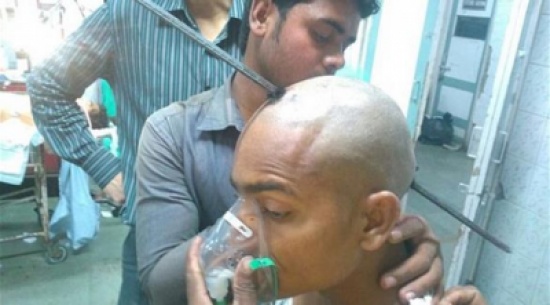 صور: لن تصدّق ما الذي اخترق جمجمة هذا الشاب