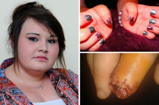 بريطانية تفقد سبابتها بسبب أظافر صناعية !