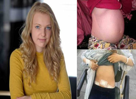 صور| استمر بطنها في الانتفاخ حتى أصبح بحجم كرة السلة.. والسبب!!