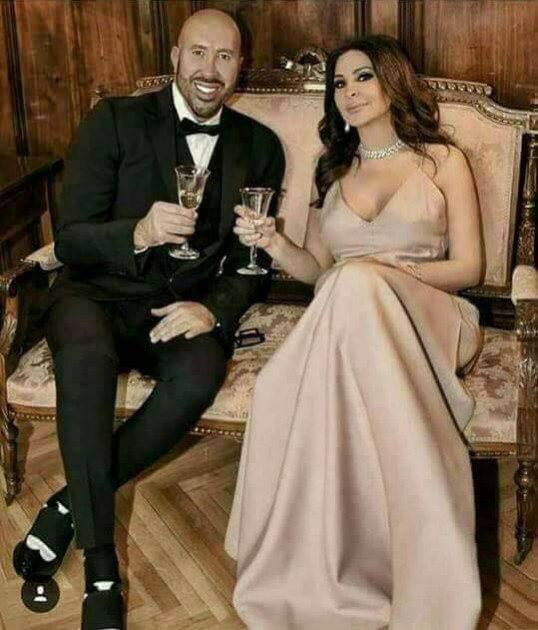 شاهد... خطيب إليسا يحقن وجهه بالبوتكس والفيلر