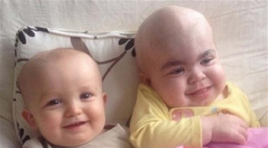 طفل يمنح الحياة لشقيقته المصابة بمرض نادر