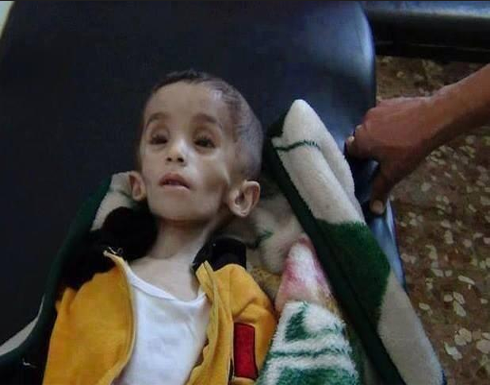 زوجين أمريكيين تركا ابنتهما تموت جوعا للاستفادة من أعضاءها