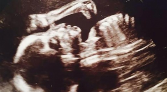 بالصورة: بريطانية حامل بديناصور بالصورة: بريطانية حامل بديناصور