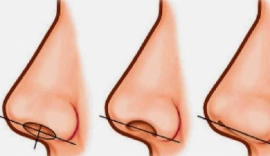 على ماذا تدل حجم فتحة الأنف لدى الانسان؟! على ماذا تدل حجم فتحة الأنف لدى الانسان؟!
