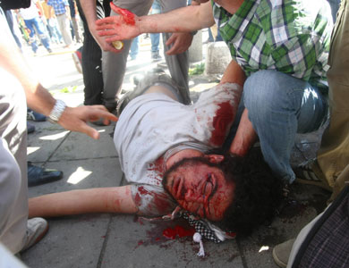 العفو الدولية: شخصين قتلا بالمظاهرات العنيفة في تركيا