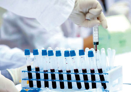 مقص بيولوجي لعلاج الإيدز مقص بيولوجي لعلاج الإيدز