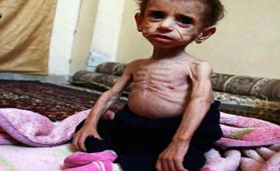 نداء استغاثة...الجوع يفتك بغوطة دمشق وأطفالها
