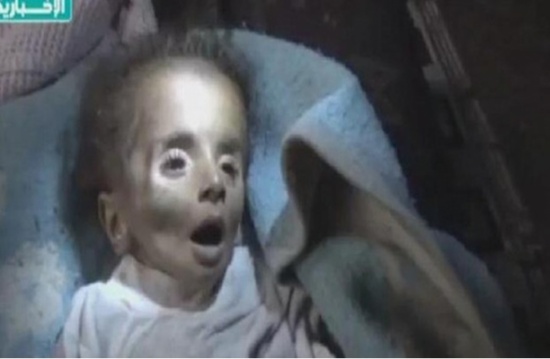 بالفيديو : لحظات أخيرة بحياة طفل في " اليرموك " يموت جوعا بالفيديو : لحظات أخيرة بحياة طفل في " اليرموك " يموت جوعا