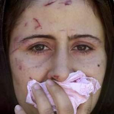 أكثر من 700 مليون امرأة حول العالم من ضحايا للعنف الزوجي أكثر من 700 مليون امرأة حول العالم من ضحايا للعنف الزوجي