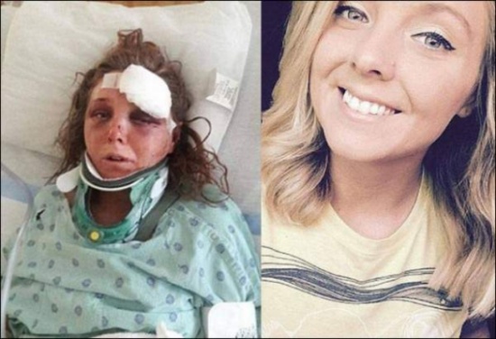 قطع قسماً من لسانها وضربها حتى الموت