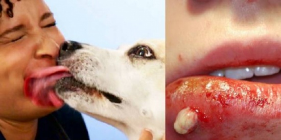خطير جدًا: لهذا السبب.. لا تسمح لكلبك بلعقك!