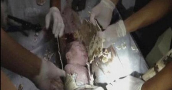 إنقاذ رضيع ألقاه أبواه بأنبوب صرف صحي