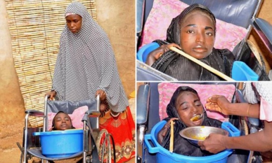 فيديو|حالة غريبة.. شابة تعيش في وعاء بلاستيكي! فيديو|حالة غريبة.. شابة تعيش في وعاء بلاستيكي!