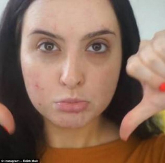 بالفيديو: نتائج سحرية.. خبيرة مكياج تخفي حب الشباب بطريقة مبهرة!