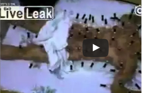 شاهد.. رجل يضع 30 كأسا على جسده للعلاج بالحجامة