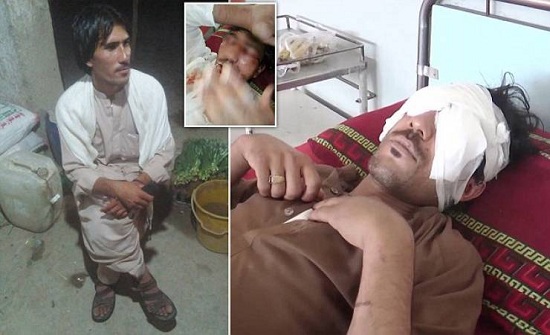 فيديو| أب يقتلع عينيْ نجله بـ'ملعقة طعام' .. والسبب صادم!