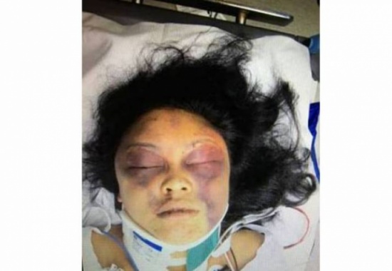 صور على الهاتف سبّبت لها نزيفاً دماغياً!