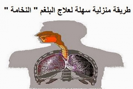 طريقة منزلية سهلة ... لعلاج ’’البلغم ’’ طريقة منزلية سهلة ... لعلاج ’’البلغم ’’