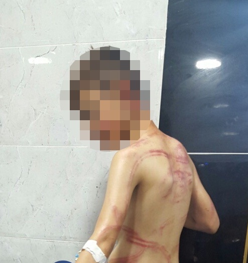 بالصور.. أب عراقي يعذب ابنه ويحبسه دون طعام بالصور.. أب عراقي يعذب ابنه ويحبسه دون طعام