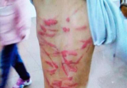 أُمّ تجلد ابنها لتقصيره في واجب مدرسي