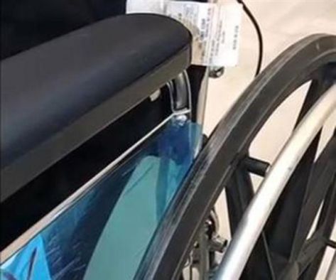 فتاة أجرت عملية تجميلية ففقدت يديها وساقيها