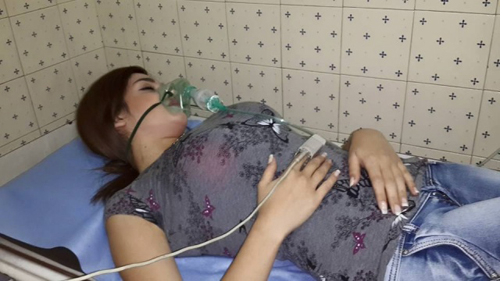 بالصور : إصابة ممثلة سوريّة بقصف الهاون في دمشق