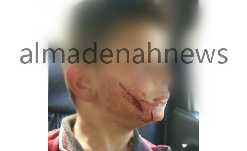 صورة : طالب يضرب زميله بسكين في وجهه بالرمثا صورة : طالب يضرب زميله بسكين في وجهه بالرمثا