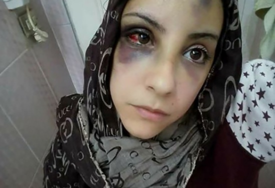 بالصور - جرّها في وسط الشارع وضربها بمساعدة والدته وإخوته ! بالصور - جرّها في وسط الشارع وضربها بمساعدة والدته وإخوته !