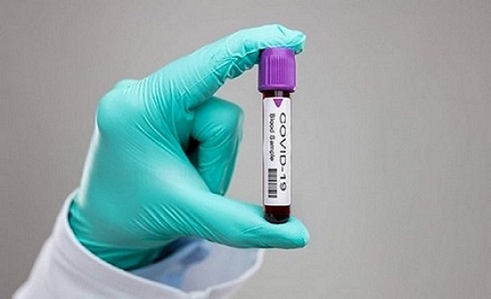5 اصابات جديدة مصابة بفيروس كورونا في الأردن