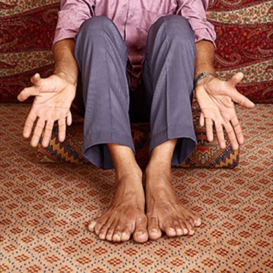 بالصور: من نوادر البشر.. رجل لديه 28 أصبعا وآخرون يمتلكون 24