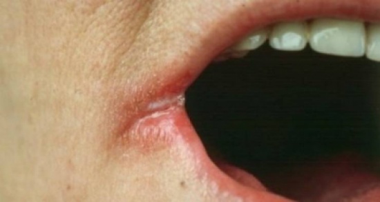 لا تستهتر بحياتك.. هل لاحظت إحدى هذه العلامات لديك؟