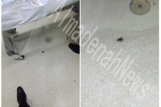 صرصور في غرفة العمليات صرصور في غرفة العمليات