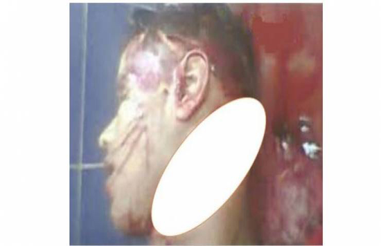 لن تتخيل كيف مزق فتى رقبة صديقه!! لن تتخيل كيف مزق فتى رقبة صديقه!!