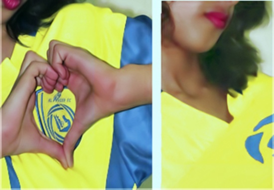 احتفال فتاة سعودية بتتويج النصر بالدوري يسبب لها عاهة مستديمة! احتفال فتاة سعودية بتتويج النصر بالدوري يسبب لها عاهة مستديمة!