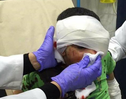 إصابة طفل مقدسي برصاصة بالرأس خلال مواجهات بالعيسوية