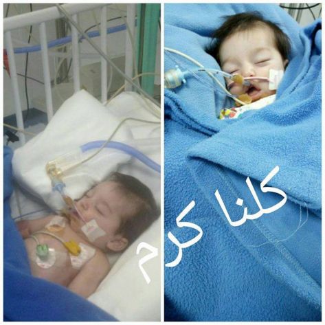 ''الحسين للسرطان'' يوضح حالة الطفل كرم