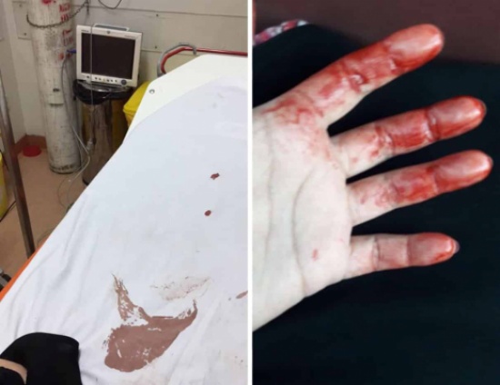 ستيني يطعن زوجته الثلاثينية داخل بقالة.. والضحية تروي التفاصيل! -صور
