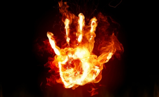 شاب يحرق نفسه في الكرك .. واصابته بالغة