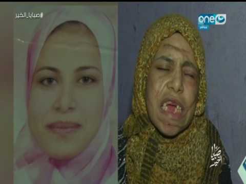 زوج يخلع أسنان زوجته بالكماشة و يشوّه وجهها بالسكين والسبب غريب جداً!… فيديو زوج يخلع أسنان زوجته بالكماشة و يشوّه وجهها بالسكين والسبب غريب جداً!… فيديو