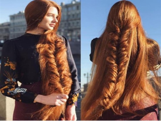 بالصور .. كيف تحولت فتاة من صلعاء إلي ملكة جمال إنستجرام