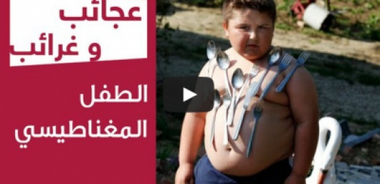 بالفيديو .. طفل مغناطيسى يجذب المعادن إليه