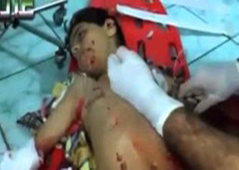 بالفيديو : طفل يوصي بالصلاة لحظة خروج روحه من جسده