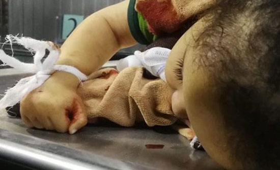 استمرار القصف : ثلاثة شهداء بينهم “طفلة وأمها” و18إصابات جراء عدوان الاحتلال على غزة