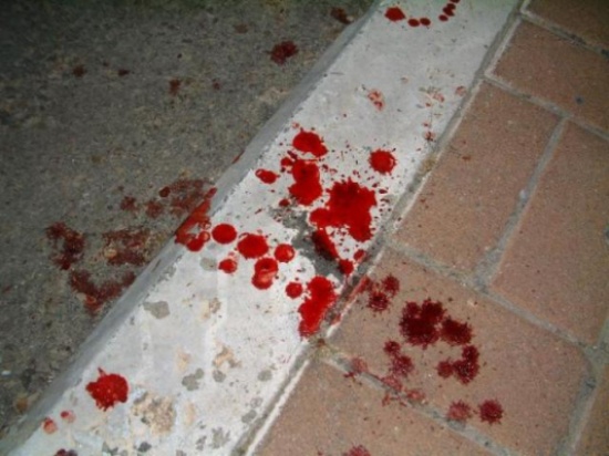 عامل وافد و مواطن يتبادلان الطعن في الكرك